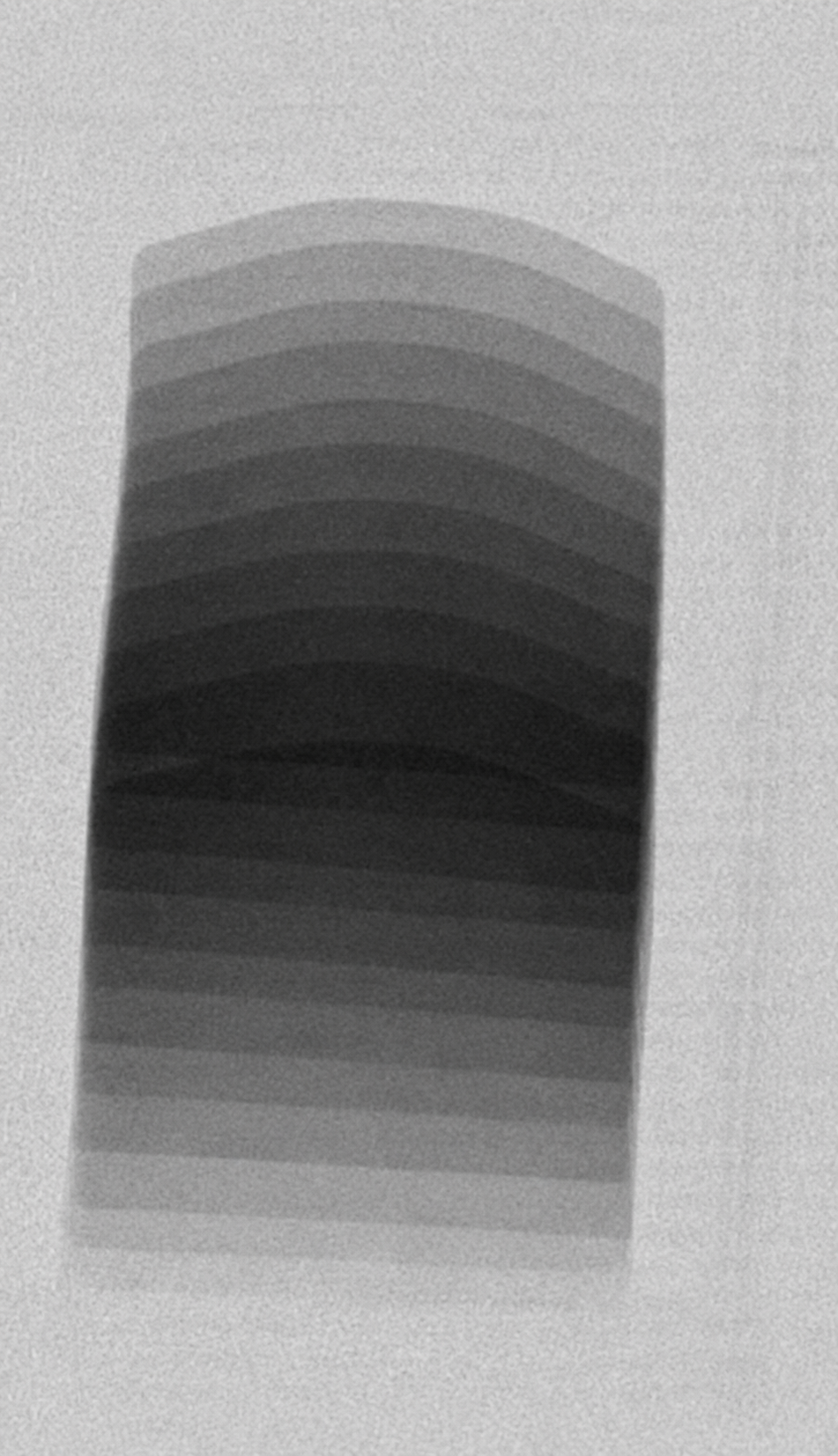 X-ray of a package with a clear seal region and no product in the seal.