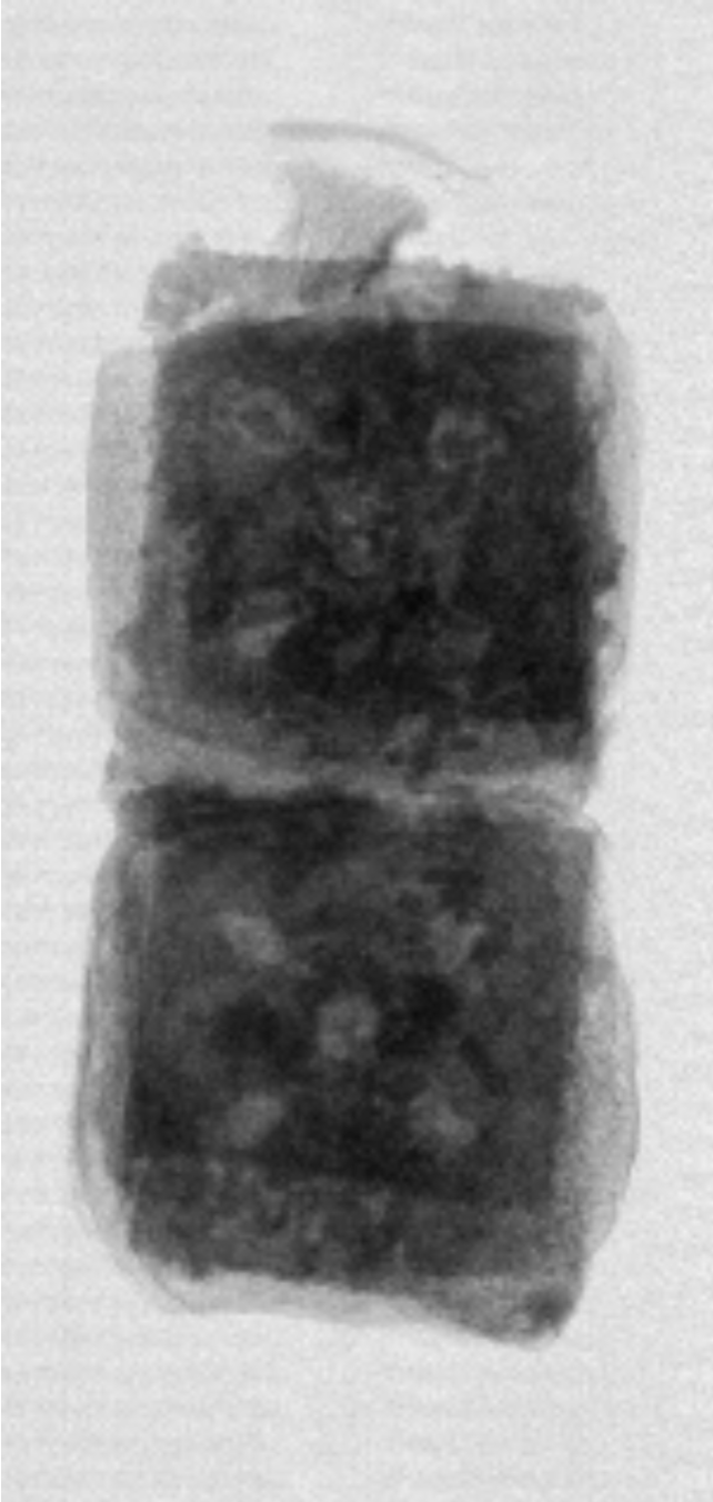 X-ray of a package with product visible in the top seal region.