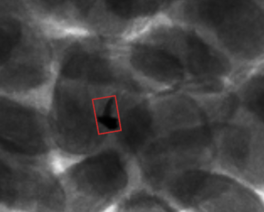Poultry bone detection X-ray image