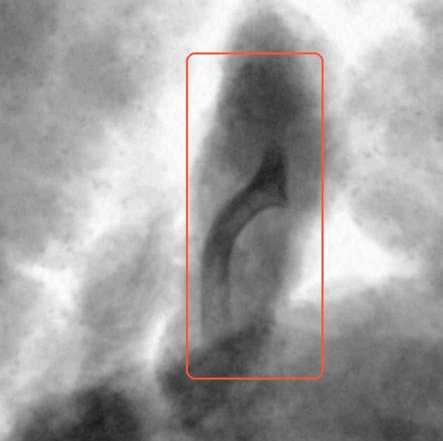 Magnified x-ray crop of the highlighted bone region in packaged chicken.