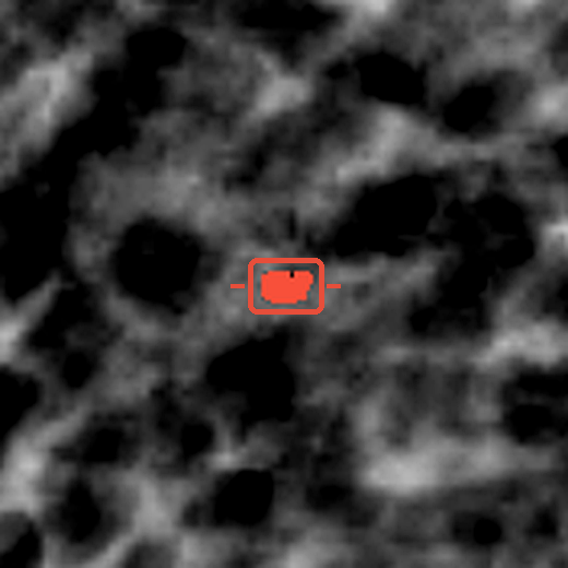 Magnified x-ray crop of the highlighted metal fragment region.