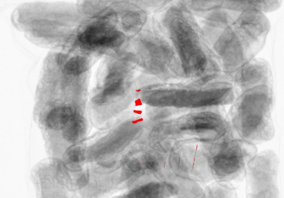 GreyscaleAI X-ray image evidence with restrained inspection target context.
