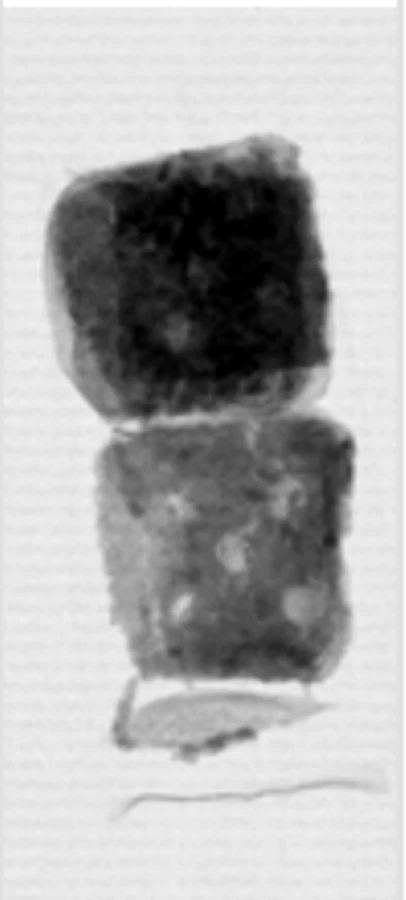 X-ray image of a prepared food assembly with a missing component